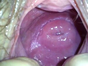 Cervix Precise Observation Porn