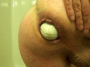 Prolapse Large Anal Fist Insertion Extreme Stretch Weird