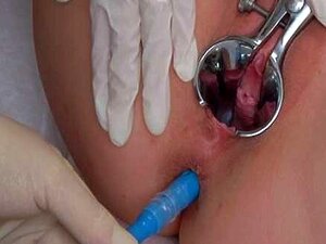 Rozalia Anal I Egzamin Na Ginekologa