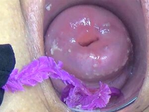 Japanese Endoscope Cam Inside Cervix And Pussy Porn